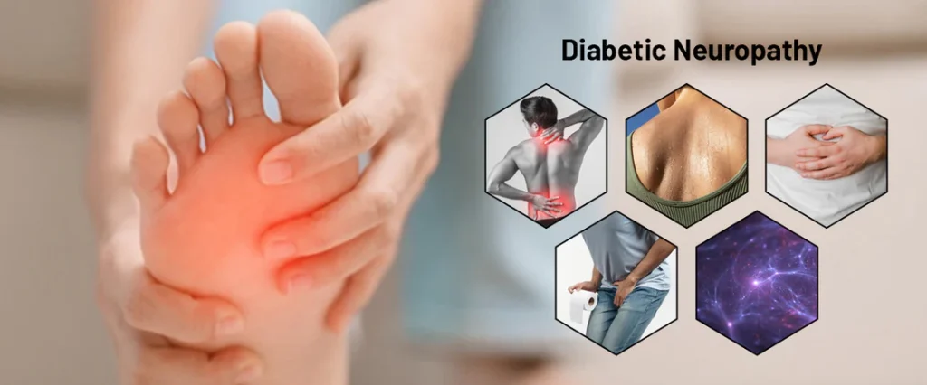 Diabetic Neuropathy