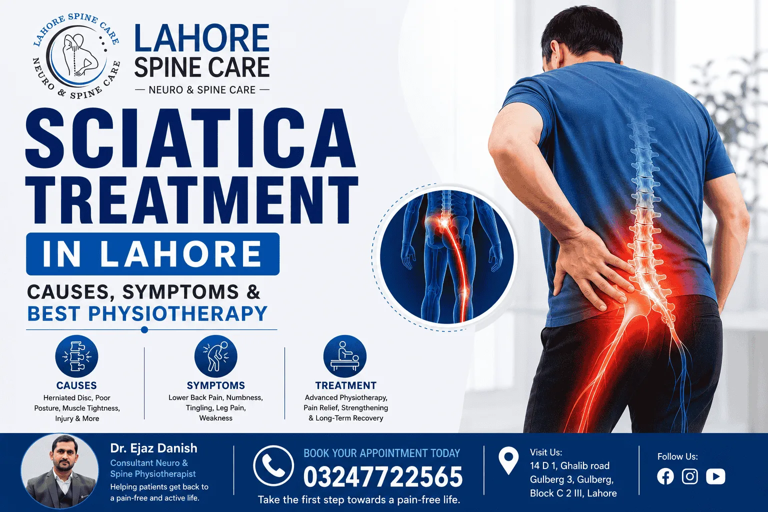 sciatica physiotherapy treatment
